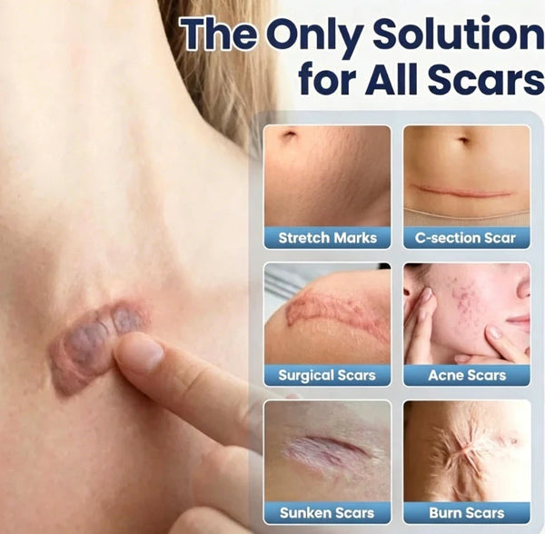NanoLipo Wart Relief Serum