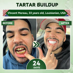SmileRenew Dental Repair Strips