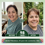 SmileRenew Dental Repair Strips
