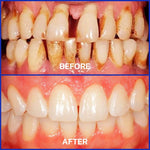 Bee Venom Toothpaste for Sensitive Gums