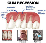 Bee Venom Toothpaste for Sensitive Gums