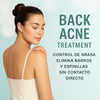 Back Acne  Spray