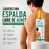 Back Acne  Spray