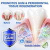 GumShield Periodontal Care Gel