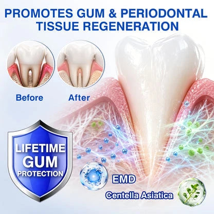 GumShield Periodontal Care Gel