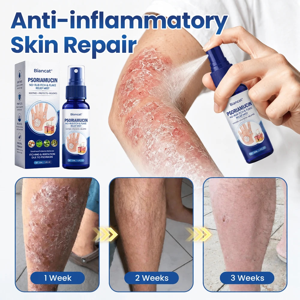 Biancat PsoriaMucin Relief Mist