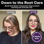 Root Revive Black Rice &amp; Onion Hair Spray
