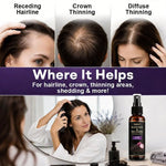 Root Revive Black Rice &amp; Onion Hair Spray