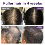 Root Revive Black Rice &amp; Onion Hair Spray