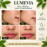 HairEase Facial Hair removal Oil