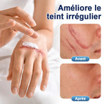 Scar Recovery Cream