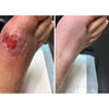 Diabetic Foot Cream for Cracked Heels