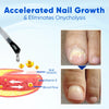 Nailvique Advanced Nail Growth &amp; Repair Serum