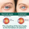 Oculisse Advanced Nano Eye Roller Serum