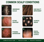 Rootelique Advanced Hair &amp; Scalp Renewal Serum