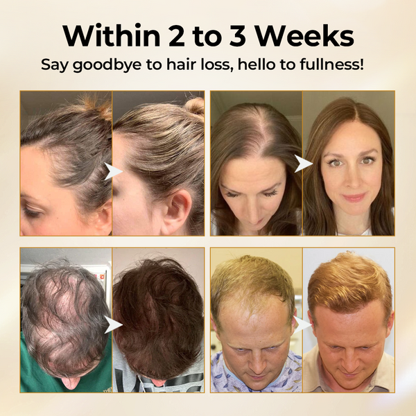 CollagenGrow Hair Restore Spray