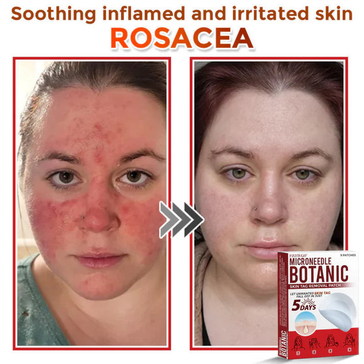 Botanic Skin Tag Removal Patch